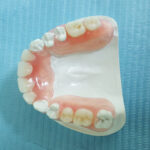 Flexi Denture and ComFlexin Dentures